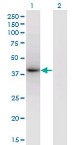 PRKCDBP Monoclonal Antibody (8D3)