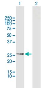 RDH13 Polyclonal Antibody, MaxPab™