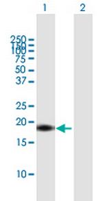 IL17F Antibody in Western Blot (WB)