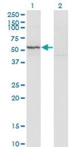 KRT71 Monoclonal Antibody (1D4)