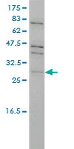 TP53RK Antibody in Western Blot (WB)