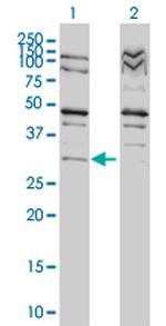 TP53RK Antibody in Western Blot (WB)