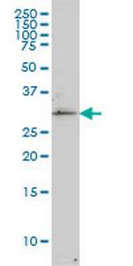 TP53RK Monoclonal Antibody (2A9)