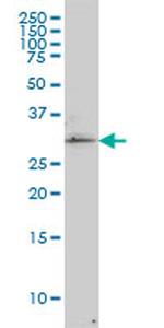 TP53RK Antibody in Western Blot (WB)