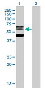 PHF21B Polyclonal Antibody, MaxPab™