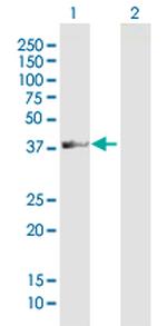 ADAT3 Polyclonal Antibody, MaxPab™
