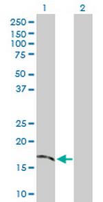 TMEM54 Polyclonal Antibody, MaxPab™