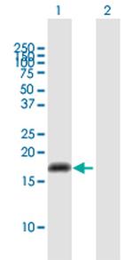 CYP2U1 Polyclonal Antibody, MaxPab™