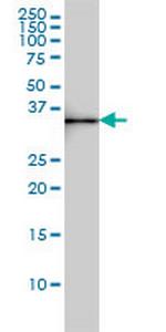 SDSL Monoclonal Antibody (M2)