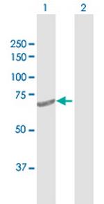 DTX2 Antibody in Western Blot (WB)