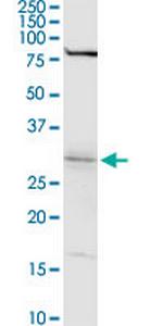 WBSCR22 Polyclonal Antibody, MaxPab™