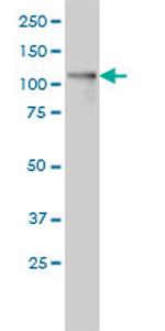 PKD1L2 Antibody in Western Blot (WB)