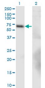 BTBD9 Monoclonal Antibody (1G3)