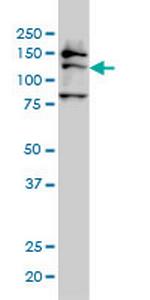 FMNL2 Antibody in Western Blot (WB)