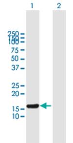 ESCO1 Polyclonal Antibody, MaxPab™