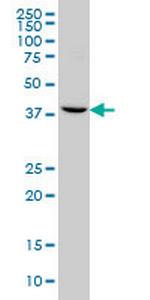 GNRHR2 Antibody in Western Blot (WB)