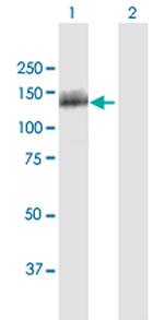 OSBPL5 Polyclonal Antibody, MaxPab™