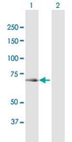 OSBPL6 Polyclonal Antibody, MaxPab™