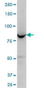 OSBPL8 Monoclonal Antibody (4H6)