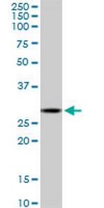 C1QTNF1 Monoclonal Antibody (4A10)