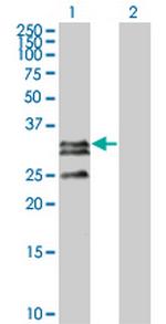 C1QTNF2 Monoclonal Antibody (1D7-2C7)