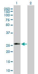 C1QTNF5 Polyclonal Antibody, MaxPab™