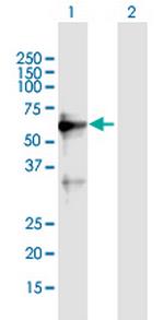 ZNF554 Polyclonal Antibody, MaxPab™
