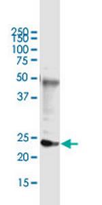 DDIT4L Monoclonal Antibody (2E6)