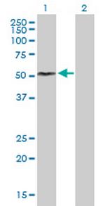 FCRL1 Polyclonal Antibody, MaxPab™