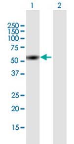 ZNF689 Antibody in Western Blot (WB)