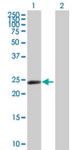 ZNF501 Polyclonal Antibody, MaxPab™