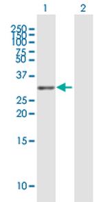 TNFRSF13C Antibody in Western Blot (WB)