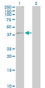 IQCD Antibody in Western Blot (WB)