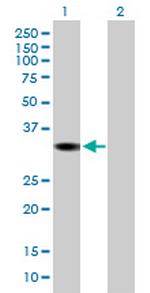 DHRS1 Polyclonal Antibody, MaxPab™