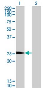 NXNL1 Monoclonal Antibody (7H3)