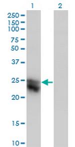 CTHRC1 Monoclonal Antibody (1G12)
