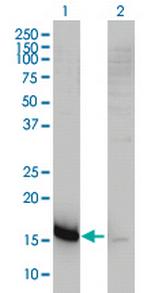 CKLFSF5 Monoclonal Antibody (2G1-6B10)