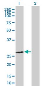 ZMYND19 Polyclonal Antibody, MaxPab™