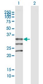 MOGAT1 Polyclonal Antibody, MaxPab™