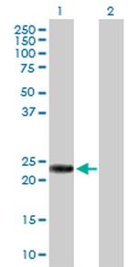 RAB39B Antibody in Western Blot (WB)