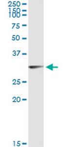 OLIG1 Monoclonal Antibody (3E3)