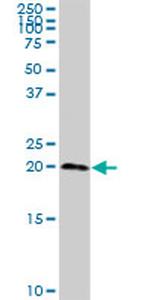 C1ORF19 Antibody in Western Blot (WB)