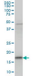 C1orf19 Monoclonal Antibody (8C7)