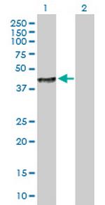 LRG1 Antibody in Western Blot (WB)