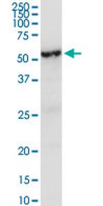 LRG1 Antibody in Western Blot (WB)
