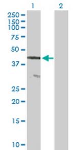 CENTG2 Antibody in Western Blot (WB)
