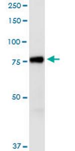 AGAP1 Antibody in Western Blot (WB)