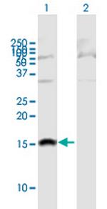 SH2D1B Polyclonal Antibody, MaxPab™