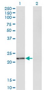 TWIST2 Monoclonal Antibody (1E2)