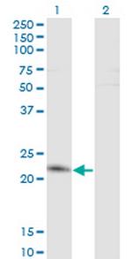 TWIST2 Monoclonal Antibody (3C12)